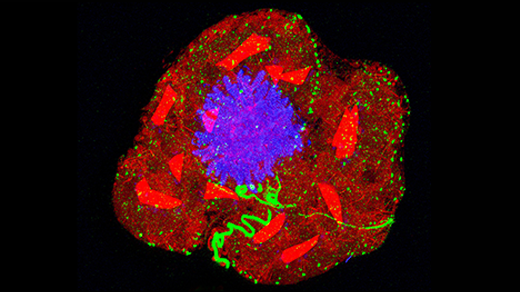 Expansion Microscopy Has Transformed How We See the Cellular World